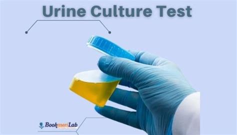 what is urine re and cs test|Urine Culture: Purpose, Results & What To Expect .